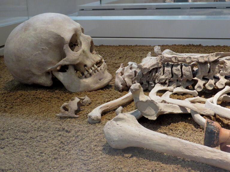 The Ethics of Displaying Human Remains